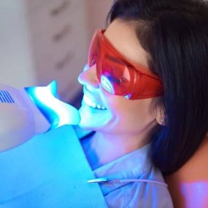 teeth whitening in Strathroy