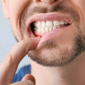 gum disease warning signs