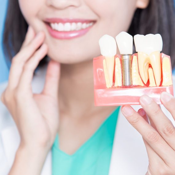 woman dentist take implant tooth and touch tooth on the blue background